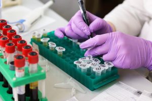 Laboratory researcher writing notes on vials for potential testing.