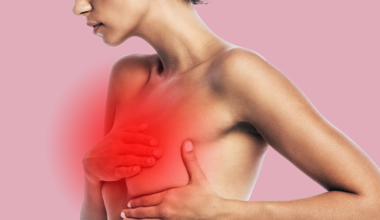 a conceptual image illustrating inflammatory breast cancer of a woman holding her breast against a pink background with a bright red spot over the breast, illustrative of inflammation because the hallmark of inflammatory breast cancer is a red rash
