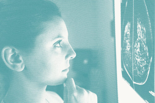 a doctor looks at a mammogram on a screen in front of her